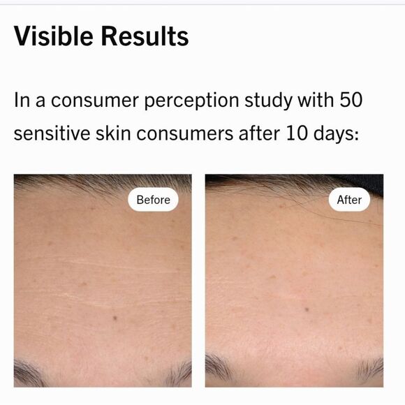 First Aid Beauty 0.3% Retinol Complex Peptides Serum NEW MSRP $48 Vegan 1st AID - Picture 6 of 12